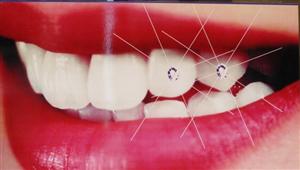 DentalTime d.o.o. za zdravstvenu djelatnost dentalne medicine DENTAL JEWELRY