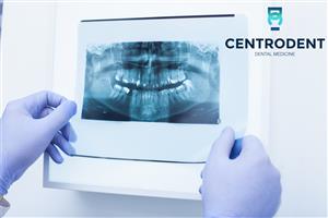 Centar dentalne medicine CentroDENT Rijeka ORTHOPAN